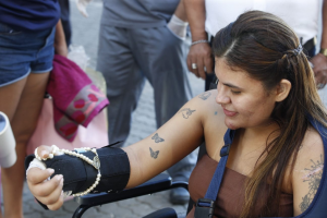 Caso Ana Clara: jovem atacada com foice sonha em voltar a mexer mãos para se comunicar em Libras com a mãe