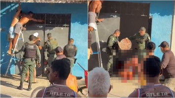 Homem é atacado por cão da raça pitbull dentro de casa em Fortaleza